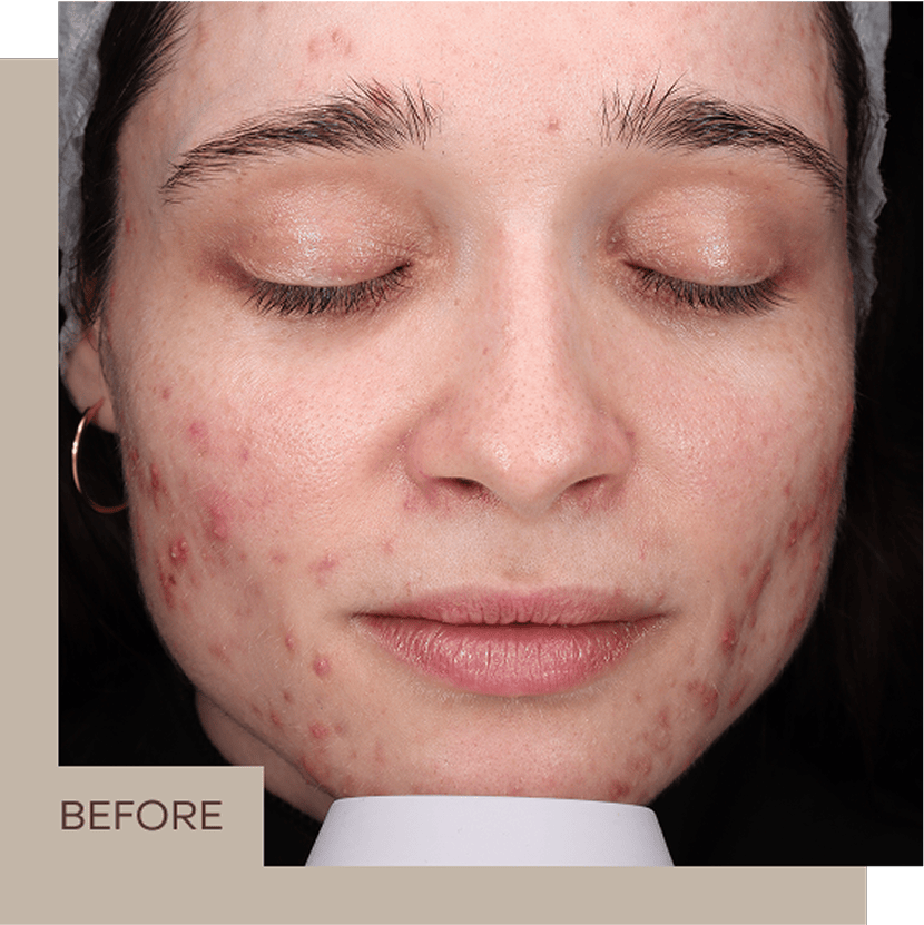 aviclear_2_B&A_centre_1