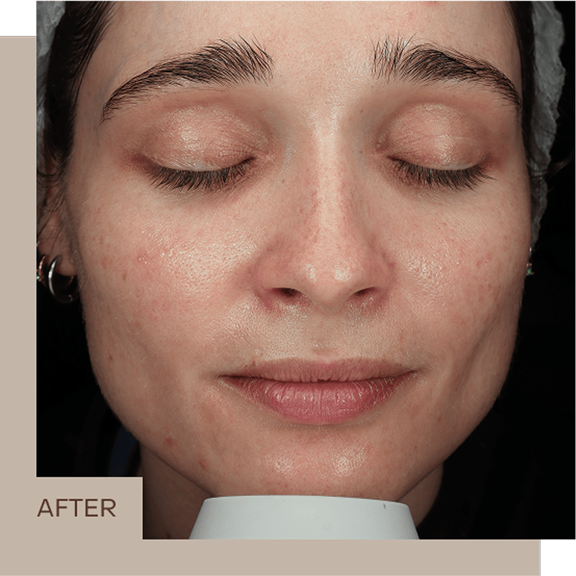 aviclear_2_B&A_centre_2