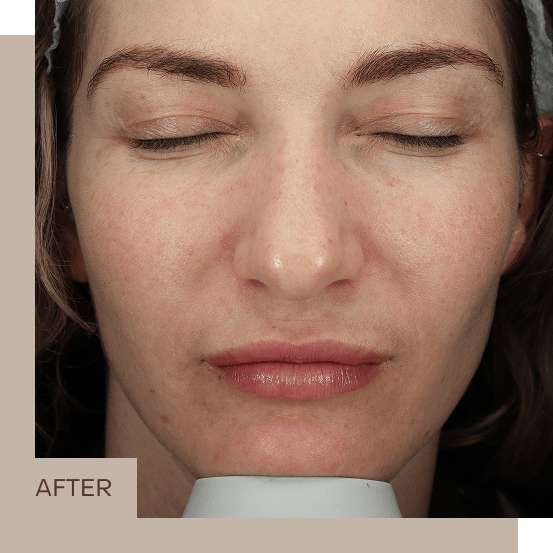 general_1_B&A_centre_2