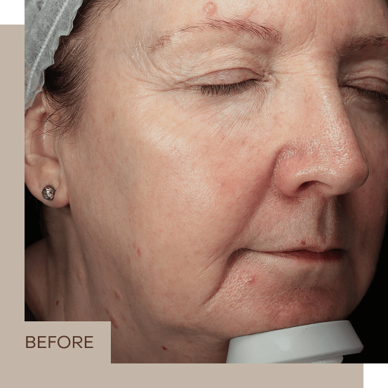 general_2_B&A_right_1