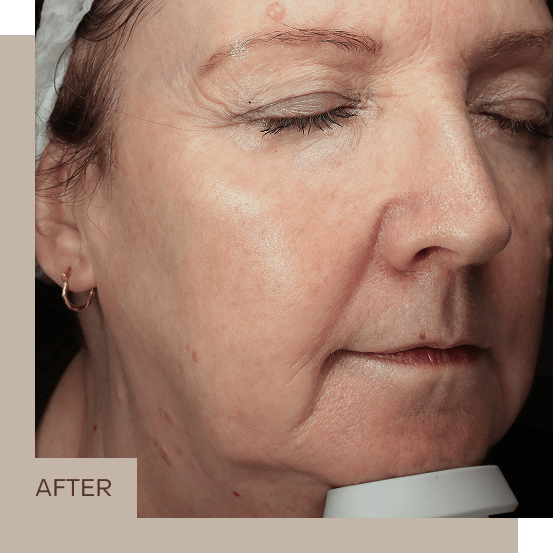 general_2_B&A_right_2