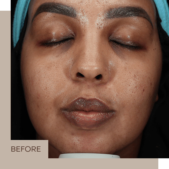 general_3_B&A_centre_1