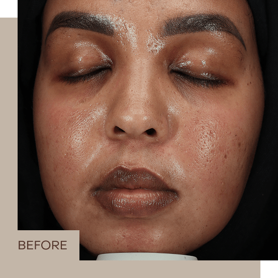 general_3_B&A_centre_2